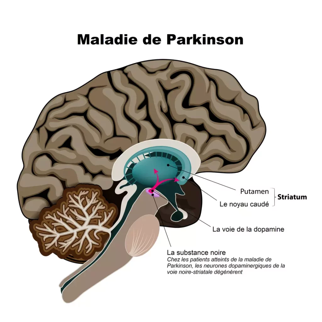 parkinson - schéma - cerveau